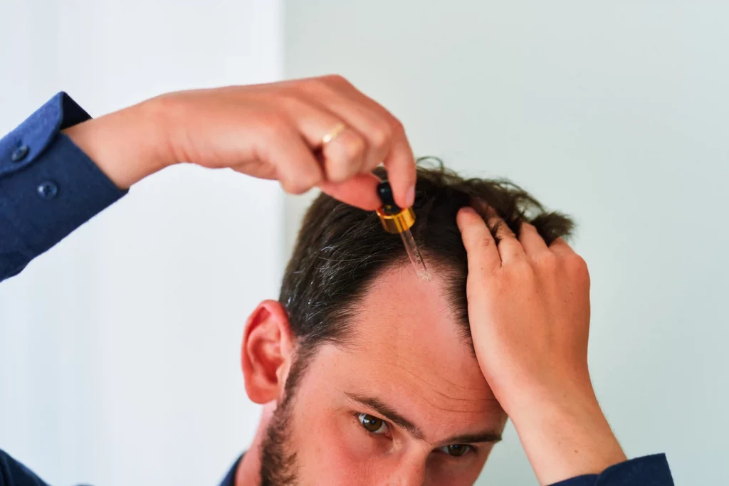 serum penumbuh rambut