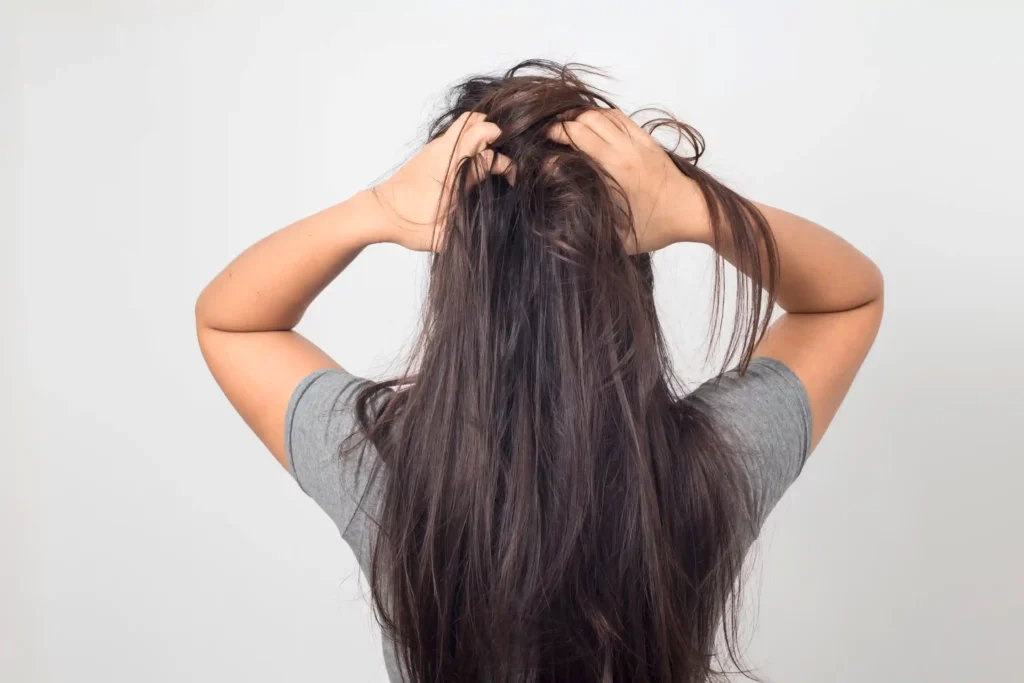 cara menghilangkan kutu rambut