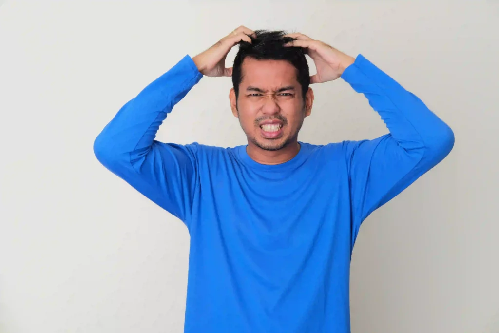 cara menghilangkan ketombe basah