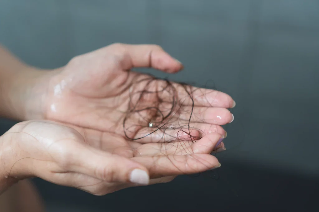 rambut rontok saat keramas